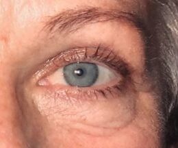 Et nærbillede af et åbent menneskeøje i blågrå nuance, belyst af varm, direkte lyskilde. Fokus ligger på irisens detaljer og kontrasten mellem mørkere pupil og lysere ring. Lange, mørke vipper og et veldefineret øjenbryn ses tydeligt, ligesom fine linjer og hudtekstur omkring øjet. Billedet er tæt indrammet og fremhæver øjets naturlige farver og strukturer uden øvrige genstande eller produkter.