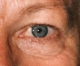 Nærbillede af et blåtgråt øje med tydelig iris, pupil og våd glans. Omgivelserne viser en mørkebrun brynkant, lys hud med fine rynker og porer samt øjenkrogens tekstur. Billedet er oplyst med varmt lys og høj kontrast, hvilket fremhæver hudens detaljer og øjets farvenuancer. Fokus er skarpt på øjet, mens resten af billedet er ude af fokus.