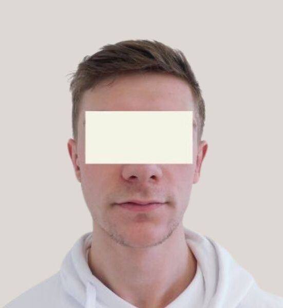 Portræt af en ung mand set forfra iført en hvid hættetrøje med synlige snore, et enkelt og afslappet tøjstykke. Ansigtet er neutralt, og øjnene er dækket af en rektangulær lys blok for anonymitet. Baggrunden er ensfarvet lys grå/beige, hvilket fremhæver den rene, minimalistiske komposition og det hvide beklædningsstykke i billedets centrum.