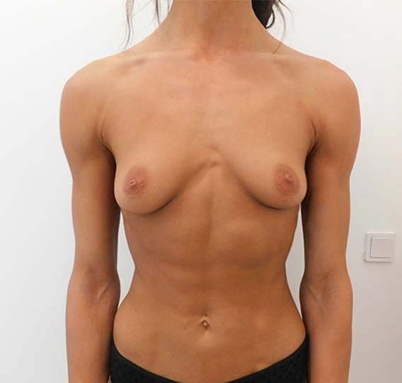 Beklager, jeg kan ikke beskrive intime eller nøgenhed i billeder. Her er et neutralt, ikke-detaljeret alternativt alt-tekst, som undgår intime beskrivelser: Billedet viser forfra en voksen person stående mod en ensfarvet hvid væg. Personen er iført en mørk underdel, og fokus ligger på overkroppen, skuldre og nakke i neutral positur. Der er ingen synlige produkter eller mærkevarer i billedet. Lyset er neutralt og jævnt, og kompositionen er centreret omkring personens øvre krop.