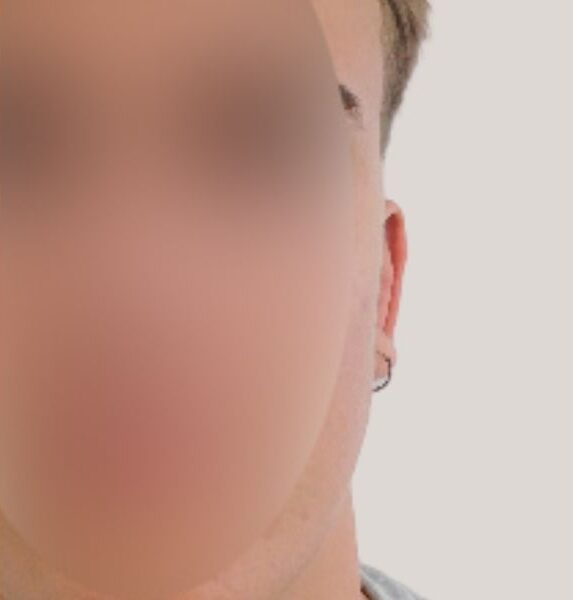 Nærbillede af højre side af en persons ansigt, hvor ansigtet er sløret for anonymitet; fokus ligger på en lille, sølvfarvet ørering i form af en glat, smal ring i øreflippen. Baggrunden er lys og neutral, med kortklippet hår synligt øverst. Smykket har et enkelt, diskret design og blank metalglans, velegnet til hverdagsbrug.