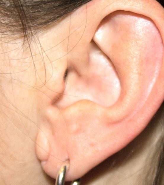Nærbillede af et venstre øre med en lille, blank sølvørering i øreflippen. Øreringen er en enkel, tynd hængende ring med glat, reflekterende overflade. Huden omkring er lys og let rødlig, med enkelte fine hårstrå synlige langs øret. Motivets fokus er smykket og piercingen, der fremhæver et subtilt og diskret dagligt øreringdesign.
