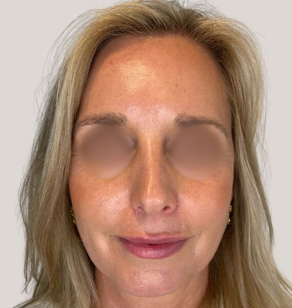 Portræt af en voksen kvinde med skulderlangt, lyst hår og en neutral, lys baggrund. Hun har naturlig makeup med en let rosatonet læbestift og glødende hud. Øjnene er sløret i billedet. Små guldøreringe ses ved begge ører. Billedets fokus er ansigtets hudtone, læber og frisuren, uden synligt produktmærke eller logo.