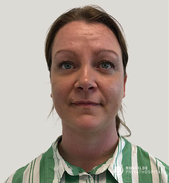 Frontal portrætfoto af en kvindelig patient hos Roskilde Privathospital, viser ansigtet i naturligt lys før ansigtsløft. Neutral mimik, hår trukket tilbage, synlige fine linjer i panden og under øjnene, iført grøn-hvid stribet skjorte, klinisk neutral baggrund. Professionelt dokumentationsfoto til præoperativ vurdering.
